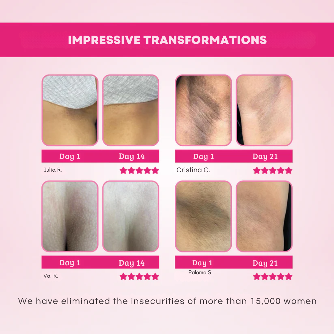 Whitening Cream